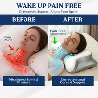 Ergonomic Cervical Neck Pillow for Neck Pain Relief, Side Sleeper Pillow, Orthopedic Pillow, Sleep Apnea Pillow, Cooling Cervical Neck Pillow, Butterfly Contour Pillow with Silk Cover & Travel Bag